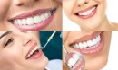 Sağlıklı ve Parlak Gülüş: Diş Beyazlatmanın Temel İlkeleri