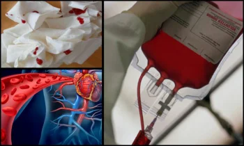 Sülük Tedavisi Hangi Hastalıklara İyi Gelir?