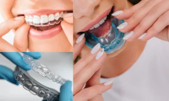 Diş Plağı Kullanmak Nedir?