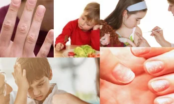 Aneminin Anlaşılması ve Semptomları