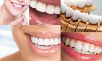 Zirkonyum Kaplama İle Doğal ve Estetik Dişlere Kavuşun