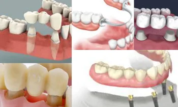 Diş Hekimliğinde Zirkonyum Maddesi Nasıl Kullanılmaya Başladı?